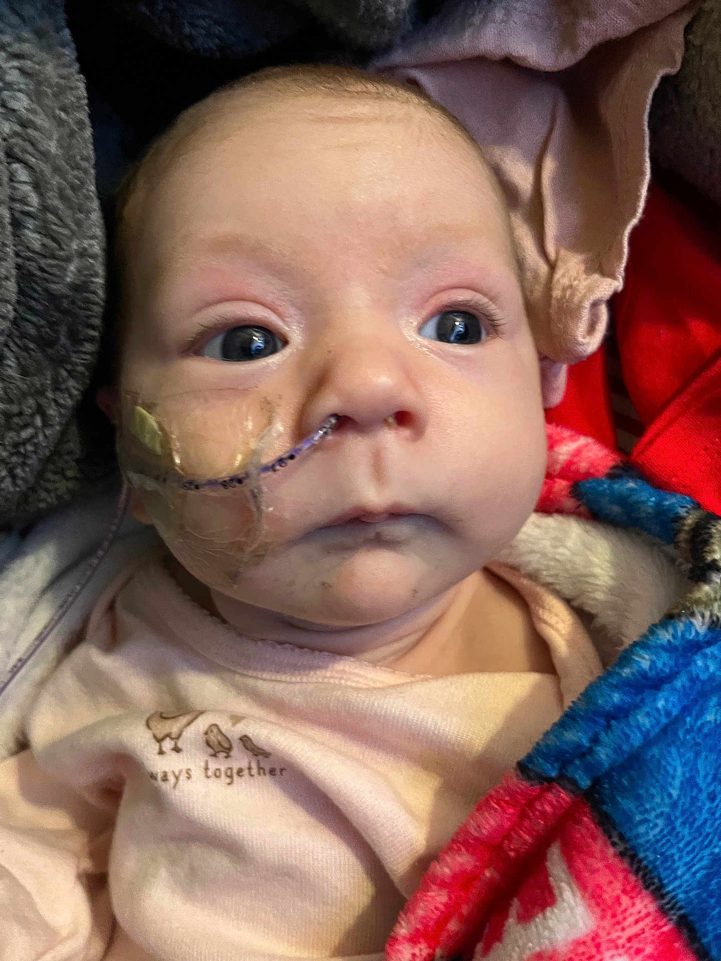 Pazleigh joined the competition — help win amazing prizes! baby, infant, newborn, face, eyes, cheeks, nasogastric_tube, feeding_tube, medical_tape, onesie, clothing, blanket, colorful_blanket, cozy, closeup, portrait, indoors, soft_texture, gaze, healthcare