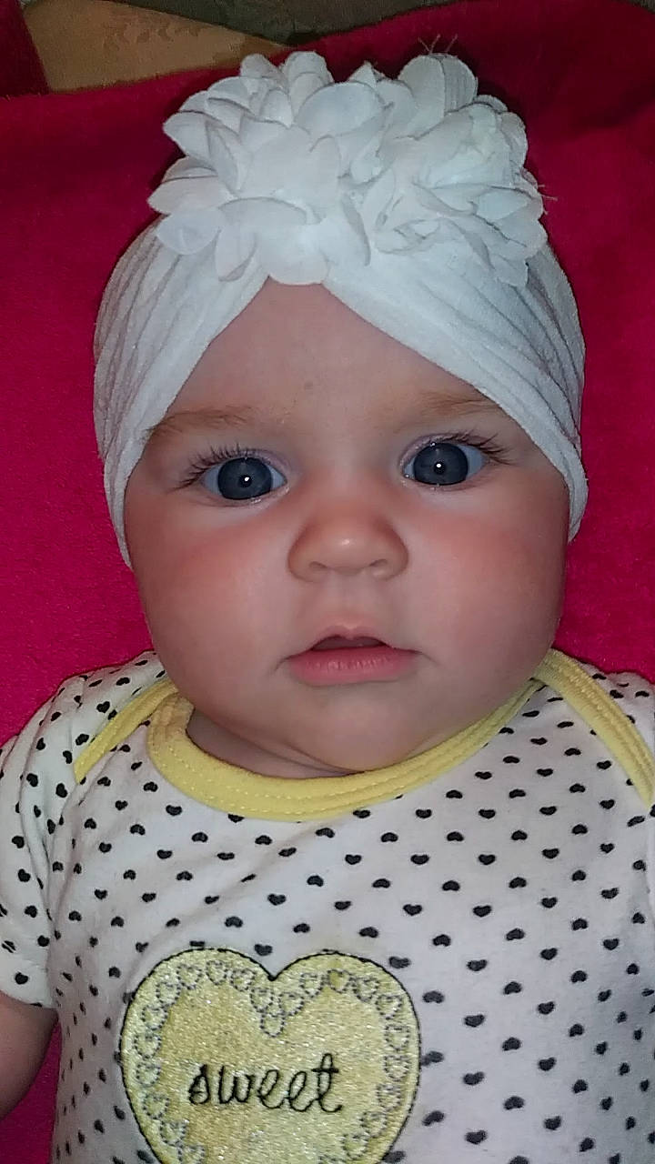 Alannah joined the competition — help win amazing prizes! baby, bonnet, cheek, child, chin, eye, face, forehead, hair_accessory, head, headgear, headwear, iris, lip, nose, person, toddler