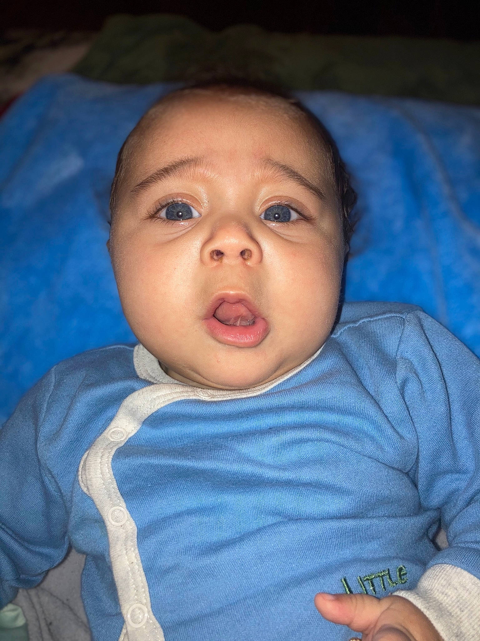 Leszeki is registered to the contest to win money with this photo: arm, cheek, chin, comfort, eye, eyebrow, flash_photography, forehead, hand, head, human_body, iris, jaw, lip, mouth, neck, nose, person, skin, sleeve