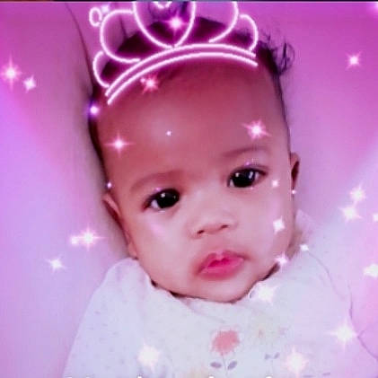 Oya participe au concours pour gagner de l'argent avec cette photo : baby, cheek, child, close_up, ear, eye, eyebrow, face, forehead, fun, hair_accessory, head, lip, mouth, nose, person, photography, pink, skin, smile