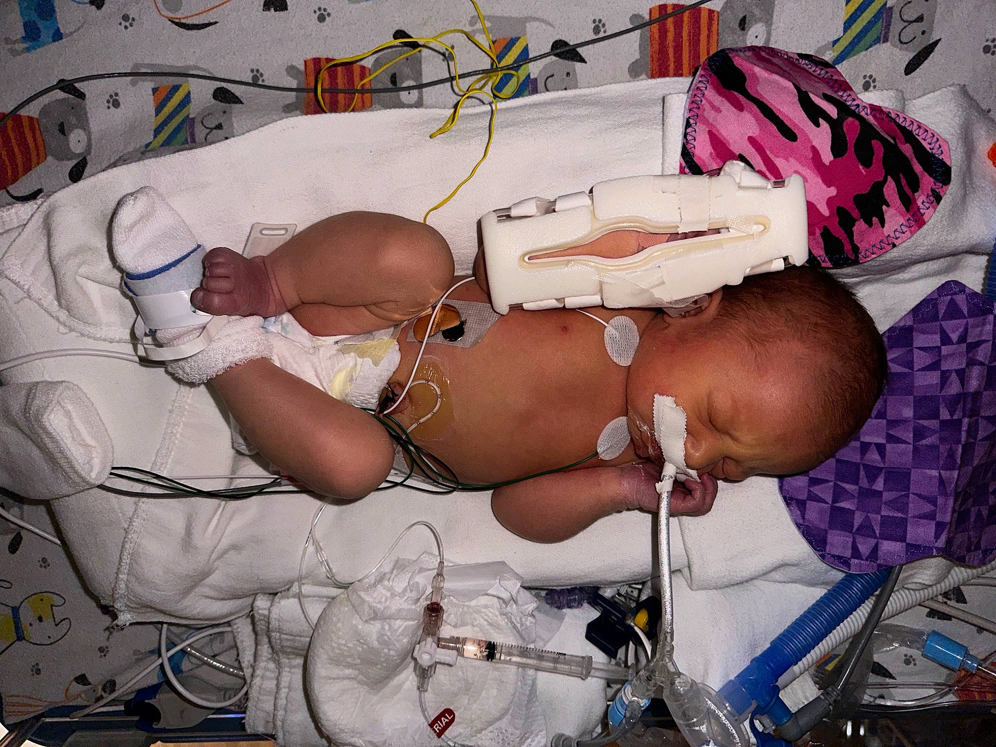 Saylor is registered to the contest to win money with this photo: abdomen, barechested, chest, child, elbow, event, eyewear, flesh, hat, jewellery, medical, medical_equipment, medical_procedure, muscle, patient, pattern, person, service, sunglasses, trunk