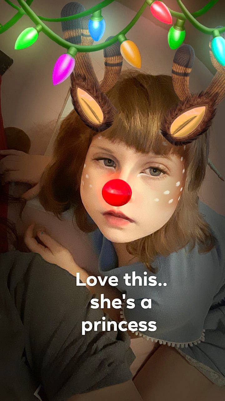 Katelynn joined the competition — help win amazing prizes! ear, easter_bunny, fawn, nose, person, photo_caption, photography, whiskers