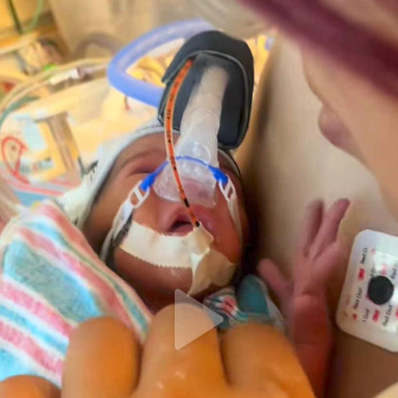 Zyalani is registered to the contest to win money with this photo: baby, blanket, breathing_mask, care, closeup, face, fragile, hand, healthcare, hospital, hospital_bed, infant, intensive_care, medical, medical_equipment, newborn, patient, person, striped_blanket, treatment