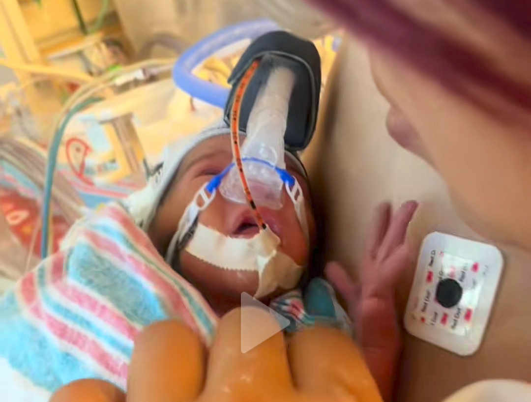 Zyalani is registered to the contest to win money with this photo: newborn, baby, hospital, medical_equipment, breathing_mask, blanket, hand, person, patient, care, treatment, infant, healthcare, medical, face, closeup, hospital_bed, striped_blanket, fragile, intensive_care