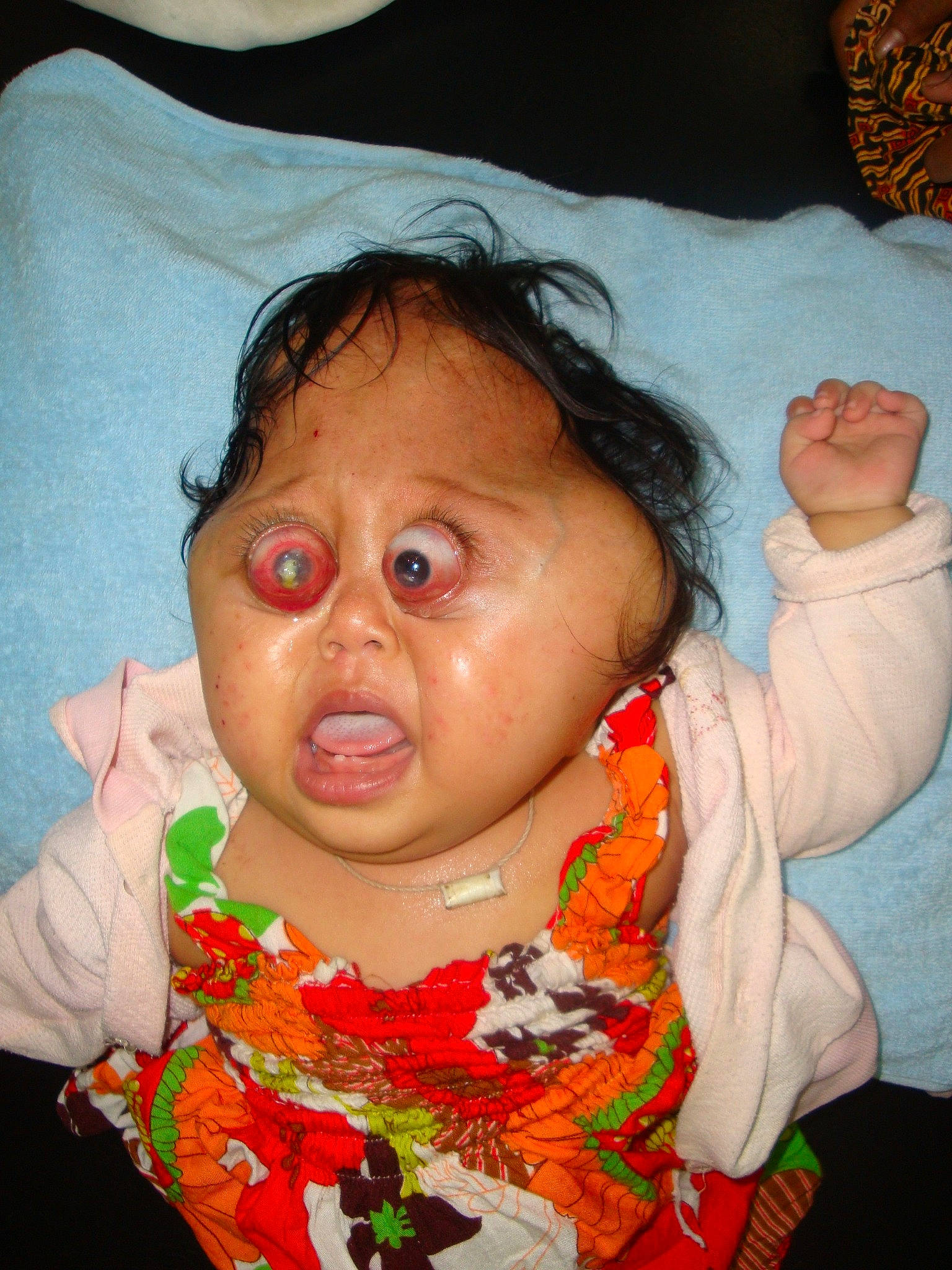 Lauryn joined the competition — help win amazing prizes! adaptation, baby, cheek, child, chin, ear, eye, face, forehead, head, iris, lip, mouth, neck, nose, person, skin, smile, toddler