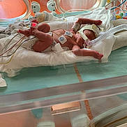 Nolan a rejoint le concours — aidez-le/la à gagner de superbes lots ! astronaut, baby, child, comfort, fun, health_care, hospital, leisure, medical, medical_equipment, medical_procedure, patient, room, service, skin, thigh, toddler, vacation, water, white