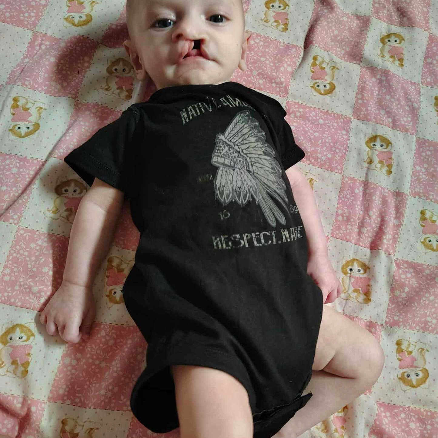 Colton Michael is registered to the contest to win money with this photo: baby, black_clothing, blanket, cartoon_animals, child, cleft_lip, cute, expression, eyes, face, head, human, indoors, infant, lying_down, onesie, patterned_blanket, portrait, skin, young_child