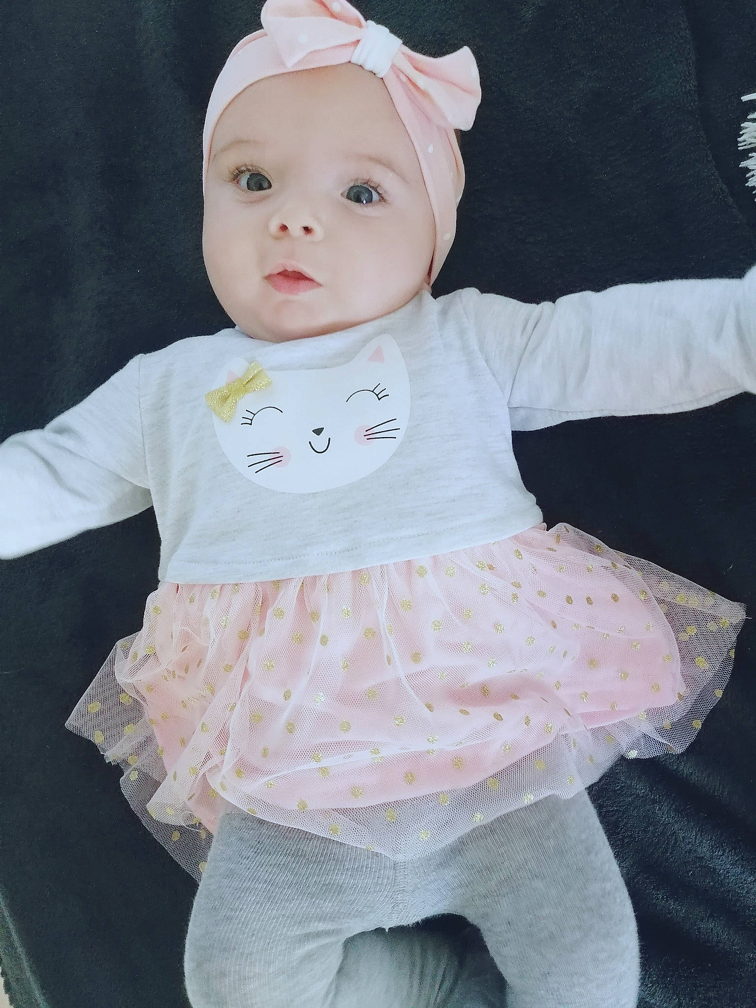 Mya a rejoint le concours — aidez-le/la à gagner de superbes lots ! arm, baby, baby_toddler_clothing, cheek, eye, eyelash, fashion_accessory, head, human_body, iris, lip, neck, outerwear, pattern, peach, pink, skin, sleeve, textile, toddler