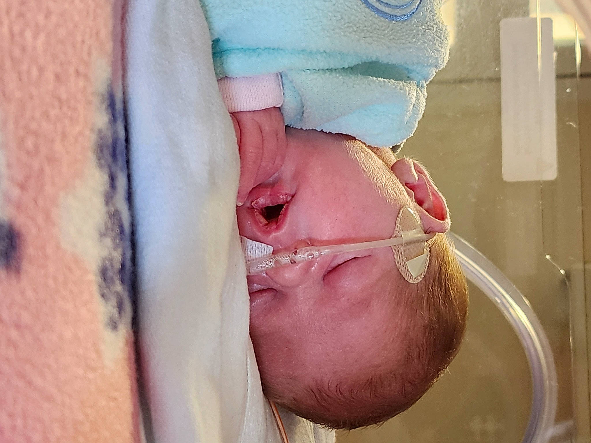 Willow joined the competition — help win amazing prizes! abdomen, baby, chest, child, elbow, eyelash, hand, human_body, human_leg, jaw, medical_equipment, mouth, neck, nose, patient, person, service, skin, sleeve, stomach