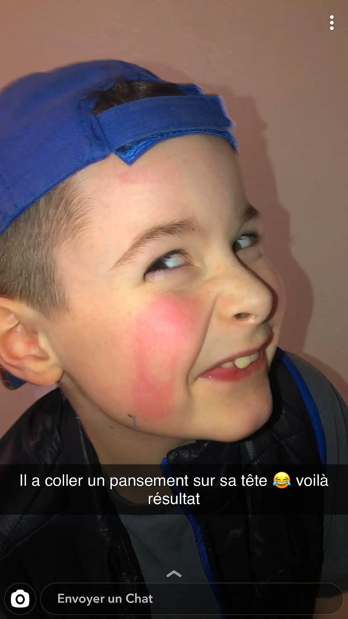 Nathan participe au concours pour gagner de l'argent avec cette photo : cap, cheek, chin, ear, eyebrow, face, fashion_accessory, forehead, hair, hair_accessory, head, headband, headgear, jaw, lip, mouth, neck, nose, person, skin