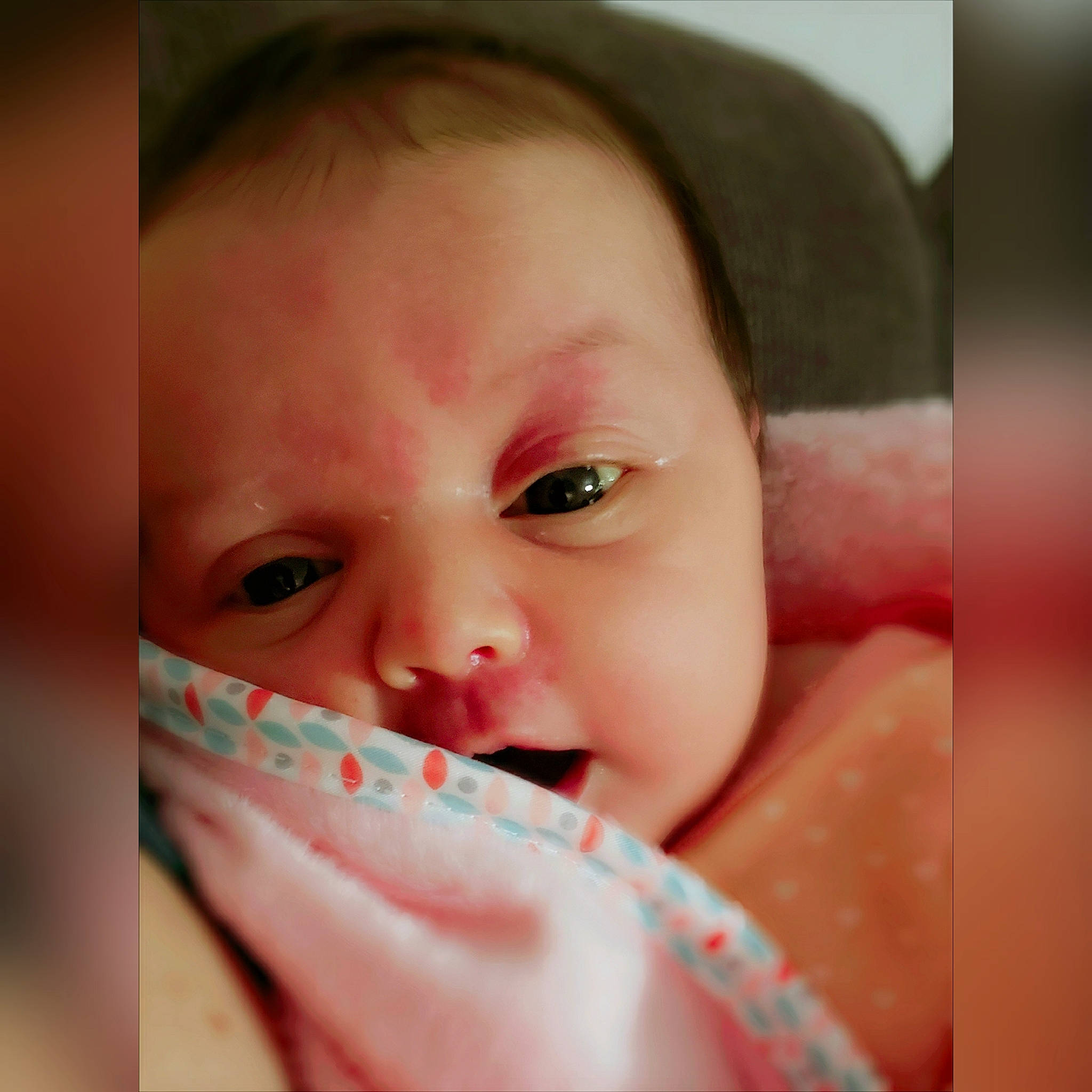 Azrael is registered to the contest to win money with this photo: cheek, child, chin, close_up, eye, eyebrow, face, finger, forehead, girl, hand, head, infant, lip, mouth, nose, person, skin, smile, toddler