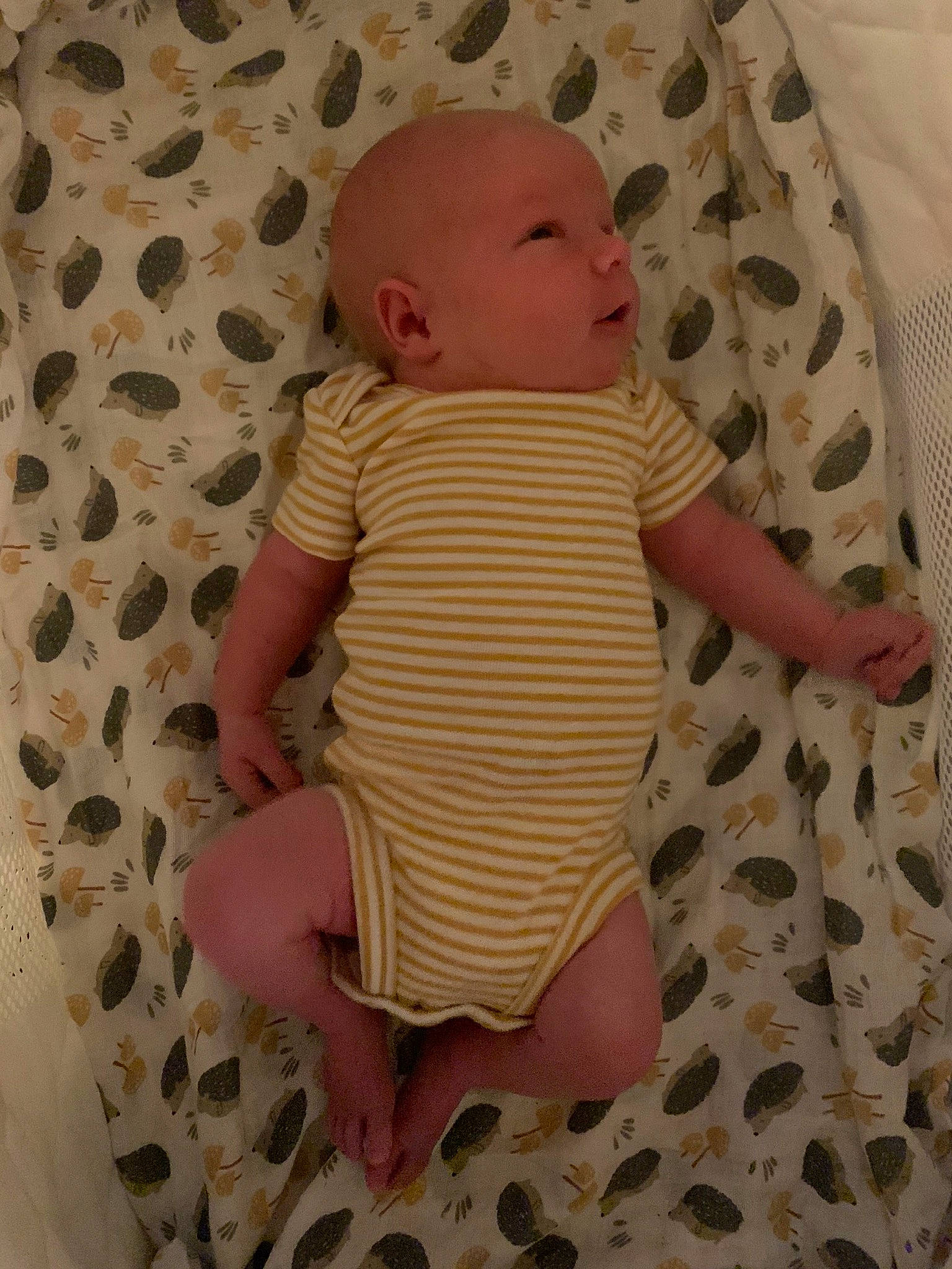 Colin is registered to the contest to win money with this photo: arm, baby, baby_toddler_clothing, cheek, comfort, eye, face, finger, human_body, infant_bodysuit, linens, pattern, person, pink, skin, sleeve, textile, thigh, thumb, toddler