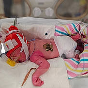 Sienna joined the competition — help win amazing prizes! newborn, baby, incubator, hospital, medical_equipment, blanket, diaper, cap, tubes, monitoring, fragile, premature, patient, healthcare, infant, sleeping, pink_skin, wired, nursery, care