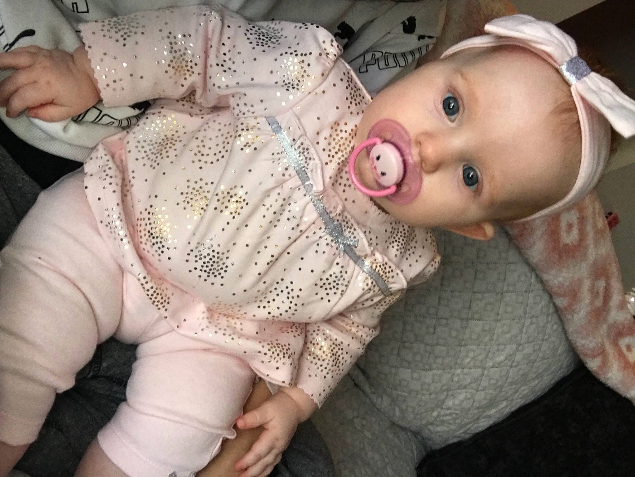 Zoey is registered to the contest to win money with this photo: baby, baby_toddler_clothing, cap, chest, eyelash, hand, headgear, human_body, human_leg, joint, lip, mouth, nail, pattern, person, skin, sleeve, thigh, toddler, trunk