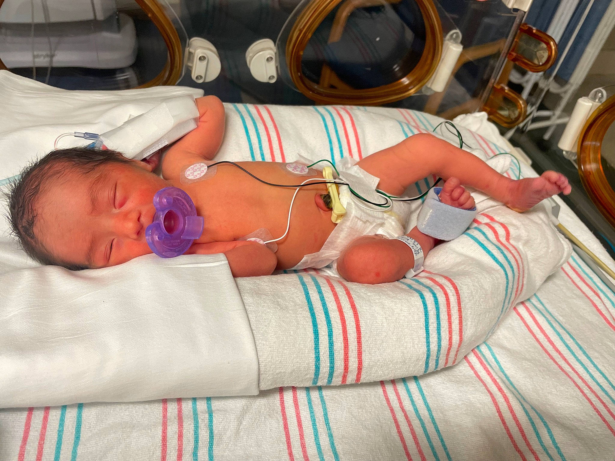 Junior is registered to the contest to win money with this photo: abdomen, baby, chest, child, comfort, event, hat, health_care, hospital, hospital_bed, linens, medical, medical_equipment, medical_procedure, muscle, patient, pediatrics, person, room, service