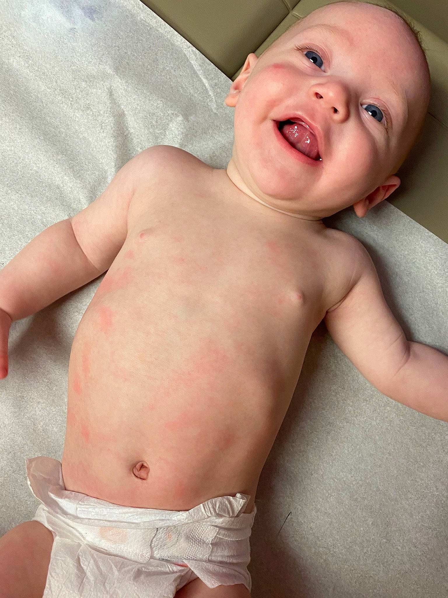 Oaklee joined the competition — help win amazing prizes! abdomen, arm, baby, barechested, cheek, chest, child, flesh, lip, mouth, muscle, neck, person, skin, stomach, toddler, trunk