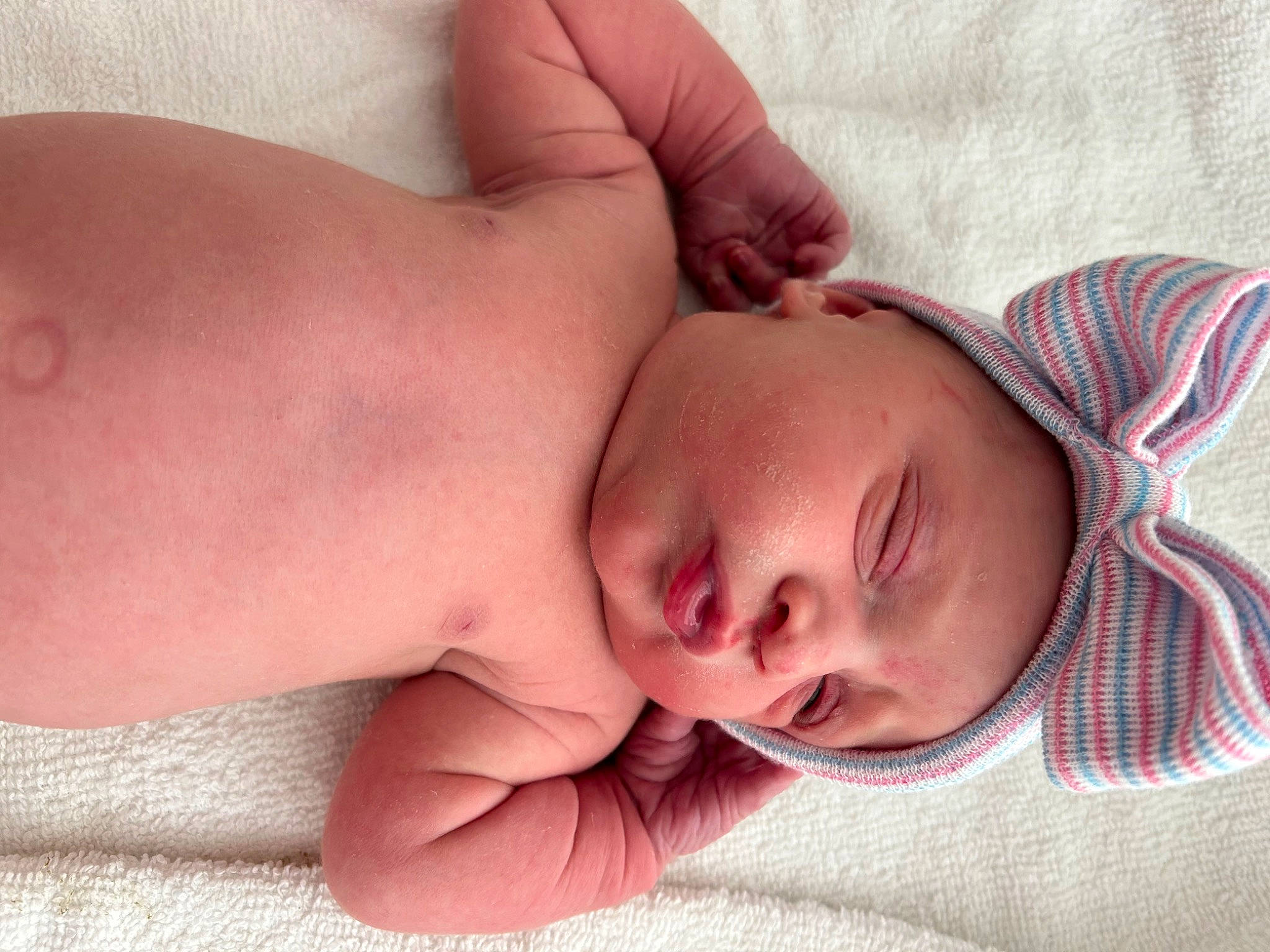 Neveah is registered to the contest to win money with this photo: arm, baby, baby_sleeping, baby_toddler_clothing, cheek, comfort, eyebrow, finger, gesture, hand, head, human_body, lip, mouth, muscle, nose, person, skin, stomach, thumb