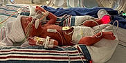 Calix joined the competition — help win amazing prizes! newborn, baby, incubator, hospital, medical_tubes, sensor, blanket, hat, foot_sensor, diaper, neonatal_care, premature_baby, bed, monitoring, medical_tape, patient, healthcare, infant, lying_down, tubes