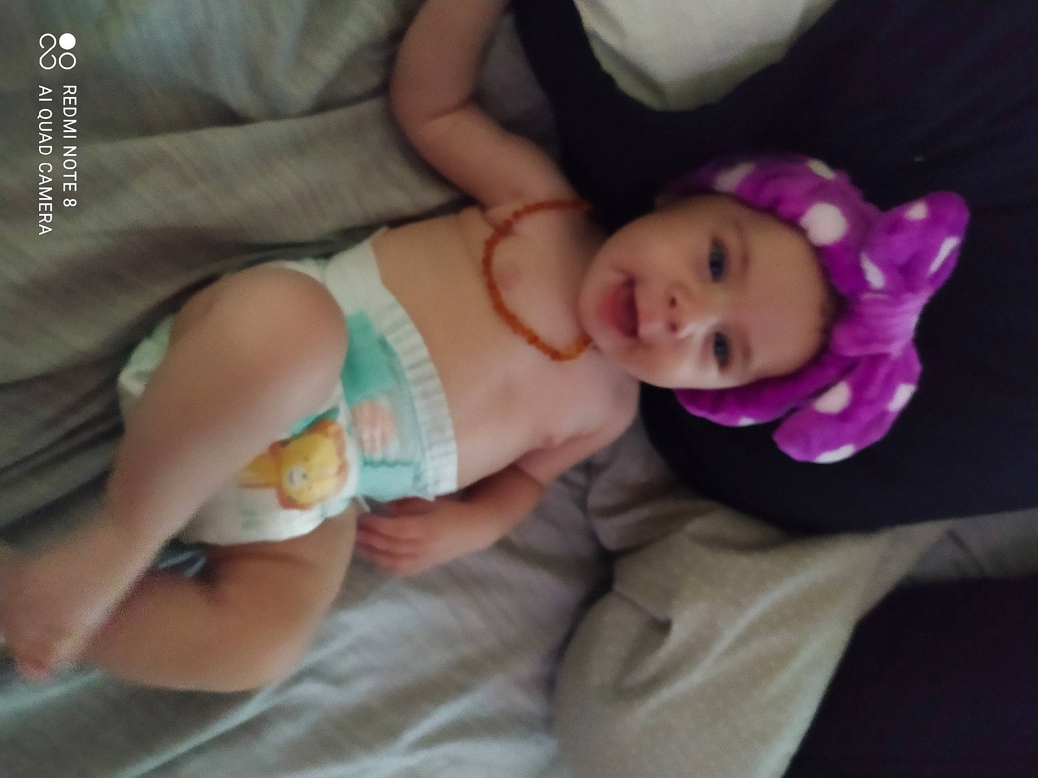 Tess participe au concours pour gagner de l'argent avec cette photo : abdomen, baby, baby_products, baby_toddler_clothing, cheek, child, comfort, eye, face, finger, hand, headwear, iris, leg, lip, nail, nose, person, product, skin