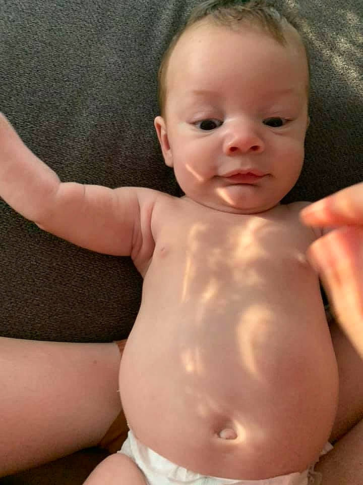 Kasimir joined the competition — help win amazing prizes! arm, baby, cheek, chin, eye, eyebrow, face, facial_expression, hand, head, human_body, joint, lip, mouth, muscle, neck, nose, person, shoulder, skin