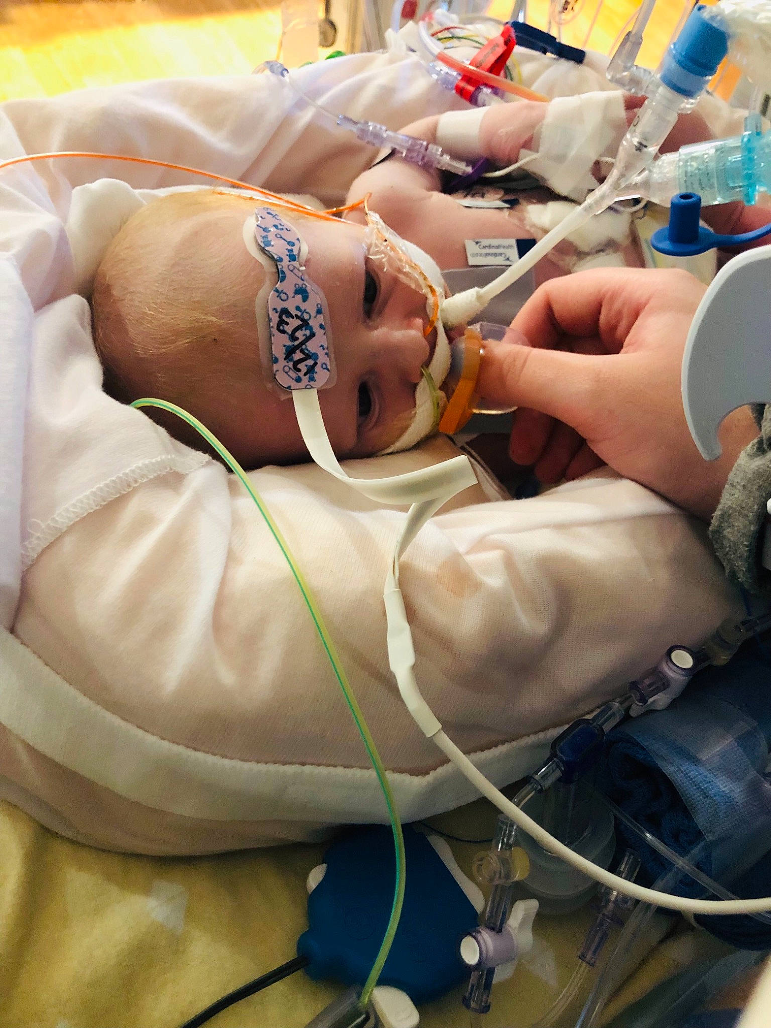 Ryker is registered to the contest to win money with this photo: abdomen, chest, elbow, event, eyewear, hand, health_care, human_leg, medical, medical_equipment, medical_glove, medical_procedure, nail, patient, person, personal_protective_equipment, service, sunglasses, surgeon, thigh