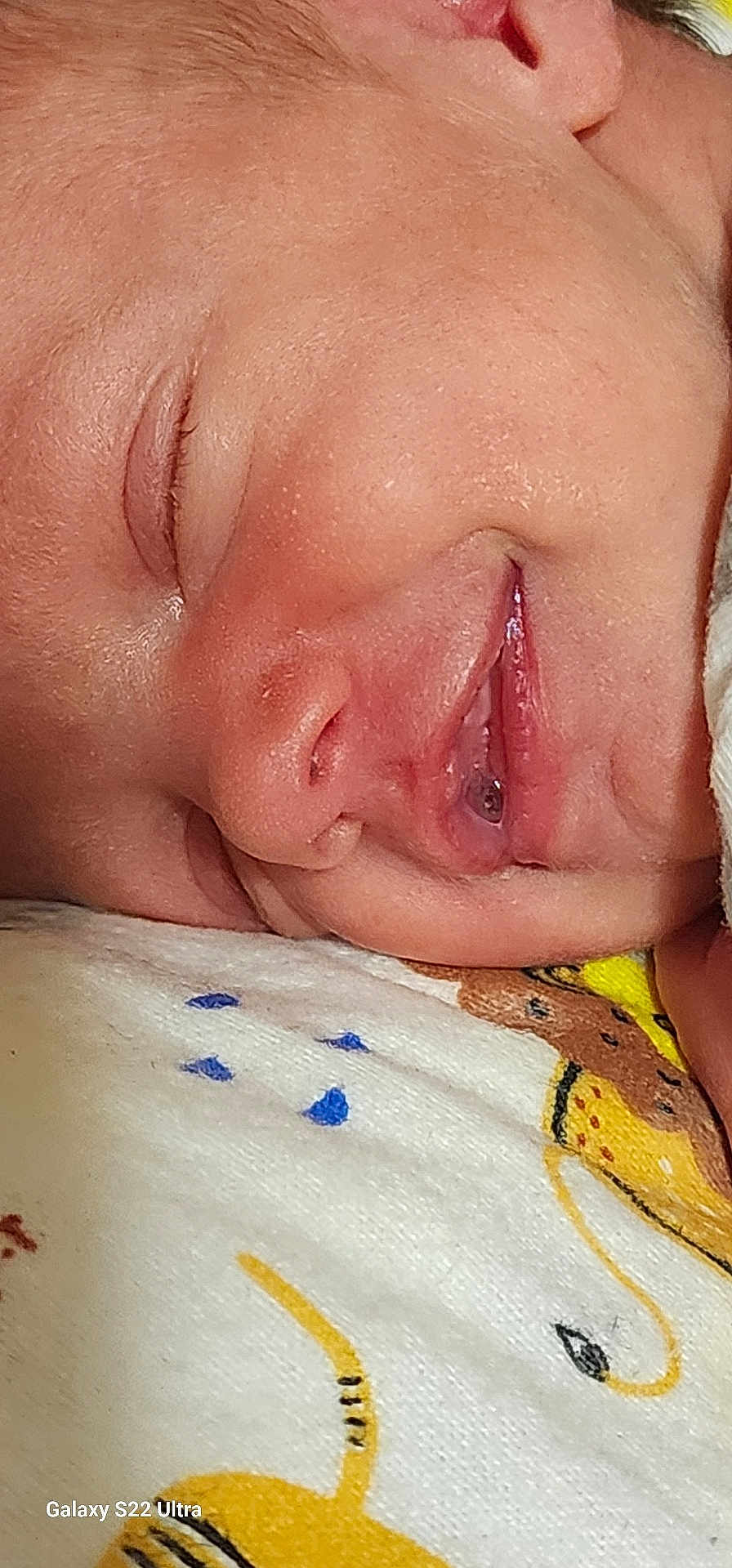 Darlene is registered to the contest to win money with this photo: baby, sleeping, closeup, face, skin, mouth, nose, eyelashes, fabric, pattern, animal_print, cute, resting, peaceful, infant, child, soft, comfort, portrait, young
