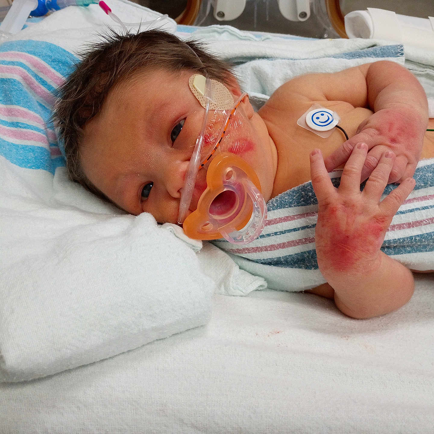 Roman is registered to the contest to win money with this photo: newborn, baby, infant, hospital, bassinet, pacifier, nasal_tube, medical_equipment, blanket, swaddle, lying_down, awake, face, eyes, hair, hand, caregiver, portrait, striped_fabric, indoor