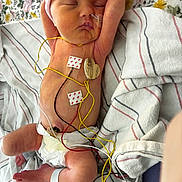 Eleanor joined the competition — help win amazing prizes! newborn, baby, infant, sleeping, medical_wires, diaper, hospital, blanket, striped, floral, monitoring, peaceful, cute, patient, healthcare, resting, wearing_hat, skin, lying_down, tubes