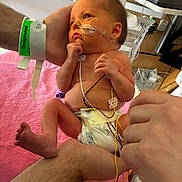 Eleanor is registered to the contest to win money with this photo: adult_hand, baby, bed, care, diaper, fragile, healthcare, hospital, infant, medical_equipment, medical_tape, monitor, neonatal, newborn, person, pink_blanket, premature, skin, tubes, wires