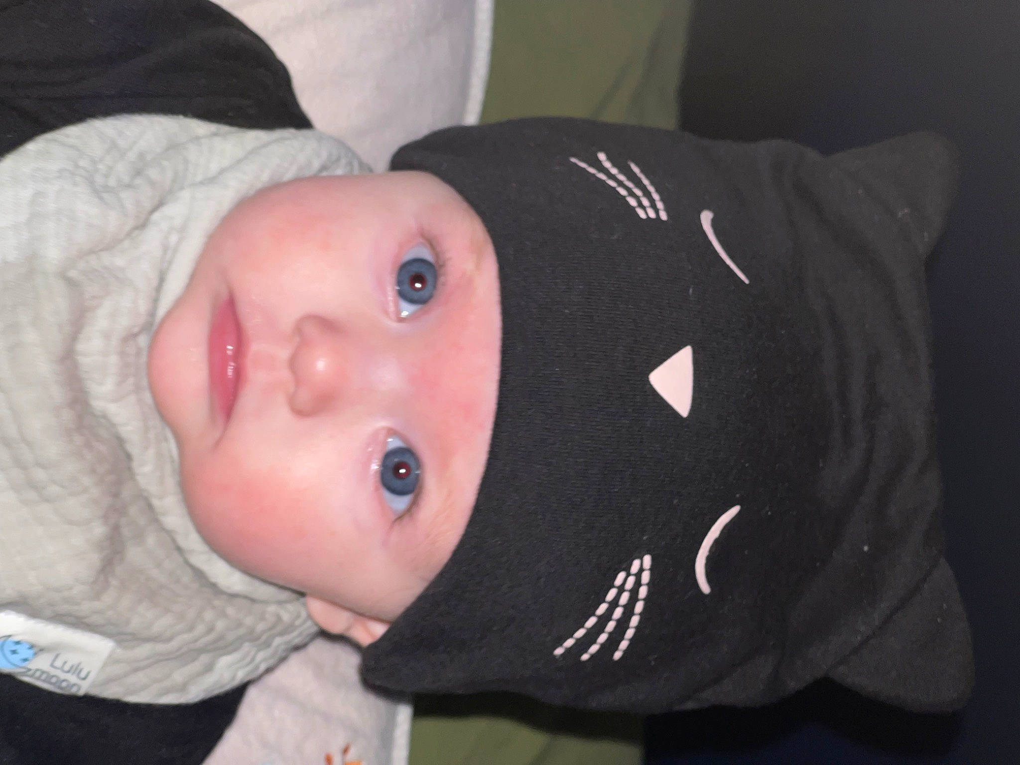 Ruby joined the competition — help win amazing prizes! baby, baby_toddler_clothing, cheek, child, eye, eyebrow, eyelash, headwear, iris, lip, mouth, nose, person, skin, sleeve, toddler