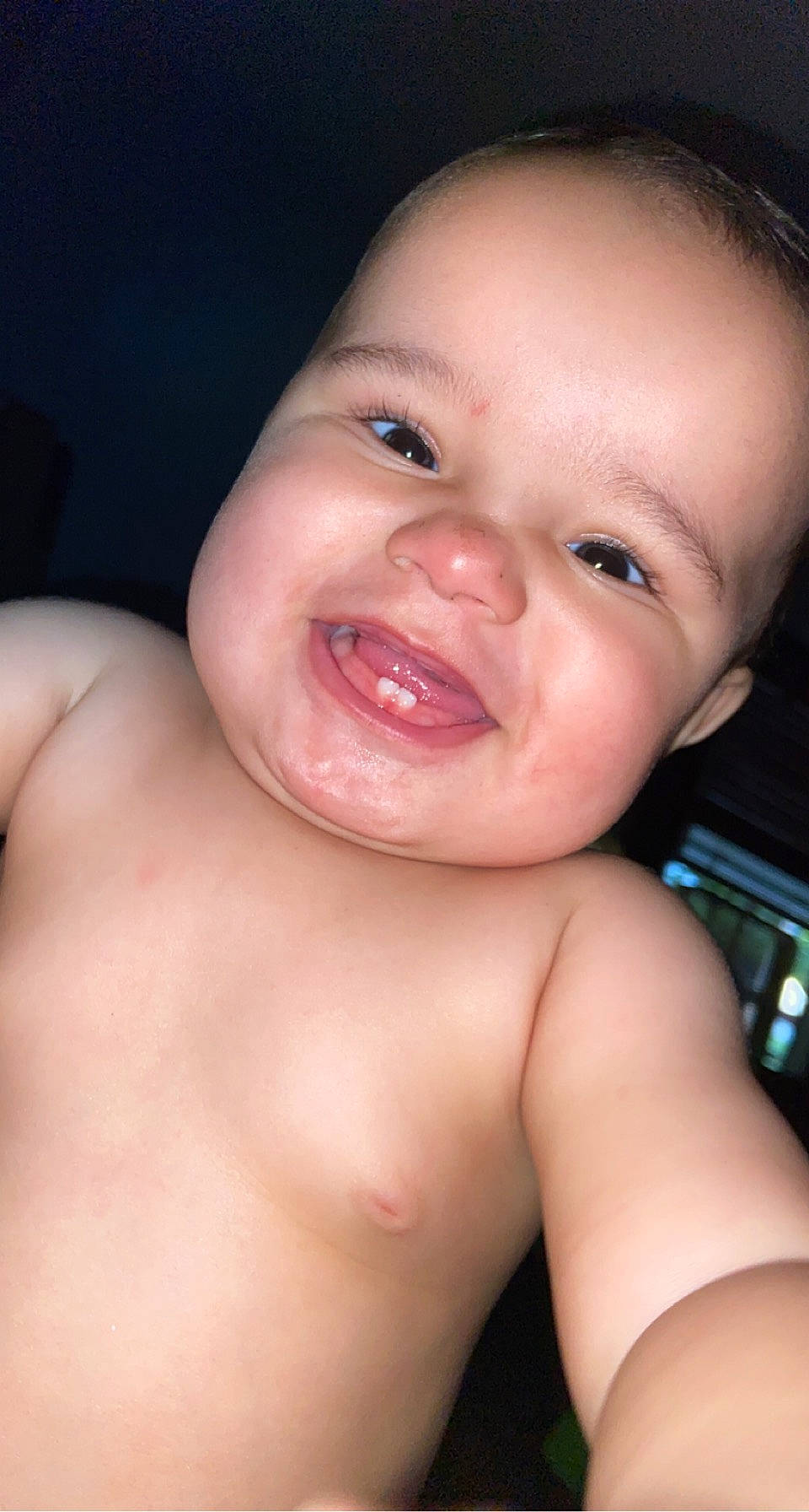 Mathias joined the competition — help win amazing prizes! arm, baby, cheek, chin, ear, eye, eyebrow, eyelash, forehead, hand, head, human_body, joy, lip, mouth, muscle, neck, nose, person, skin