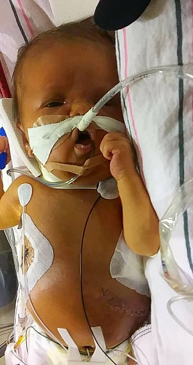 Ronald is registered to the contest to win money with this photo: glasses, medical, medical_equipment, mouth, nose, oxygen_mask, stethoscope