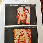 Alyan participe au concours pour gagner de l'argent avec cette photo : abdomen, advertising, arm, art, barechested, chest, chin, finger, flesh, font, human_anatomy, human_body, knee, material_property, navel, publication, stomach, thigh, thumb, trunk